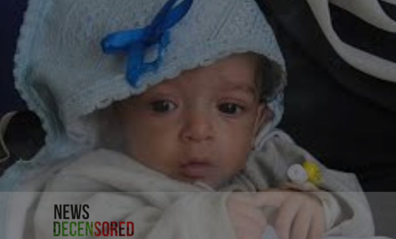 According to United states experts: Gaza children dying in Israel's 'targeted starvation campaign