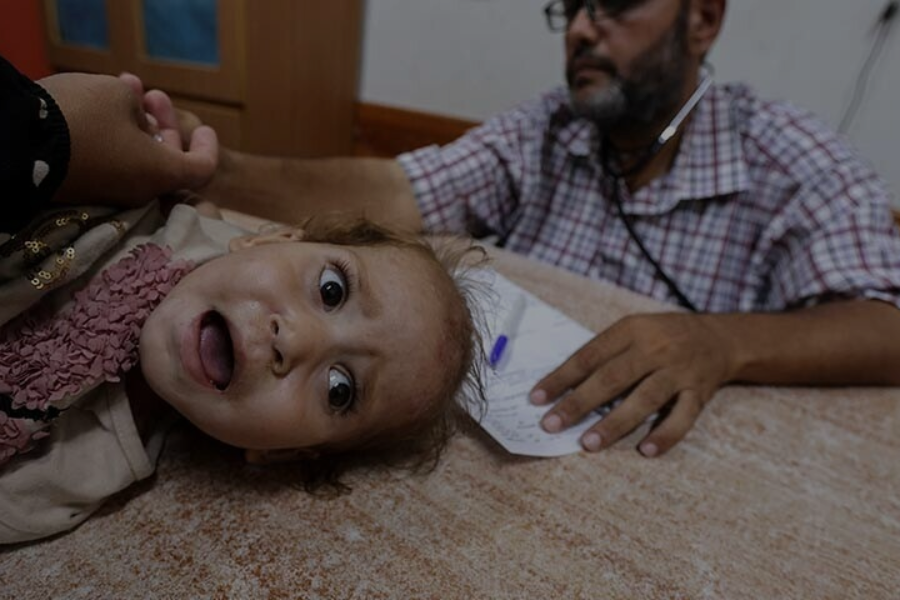 Parents Fear for children’s health as polio re-emerges in Gaza