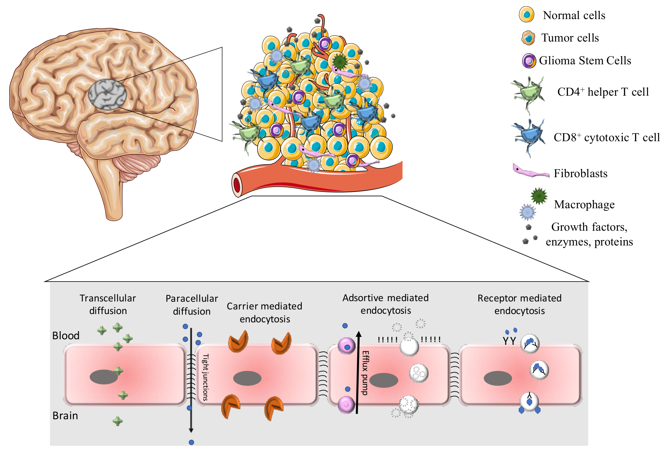 Researchers Develop Breakthrough Nanoparticle Treatment for Deadly Brain Cancer