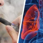 New Study Links Vaping to Immediate Vascular Dysfunction, Even Without Nicotine